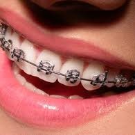 L'orthodontie